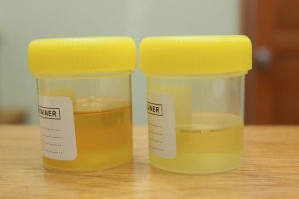 Synthetic Urine Quick Fix Los Duranes Albuquerque NM